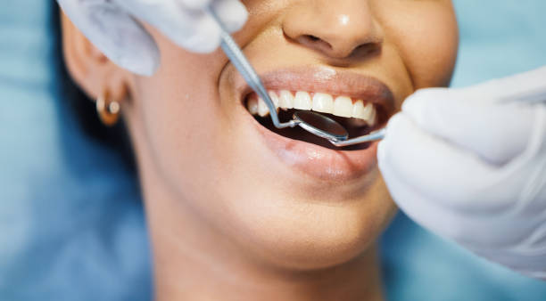 Best Walk-In Emergency Dentist in Terre Du Lac, MO